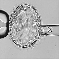 Embryo Biopsy